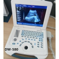 2017 hot sale ultrasound machine portable & ultrasonidos